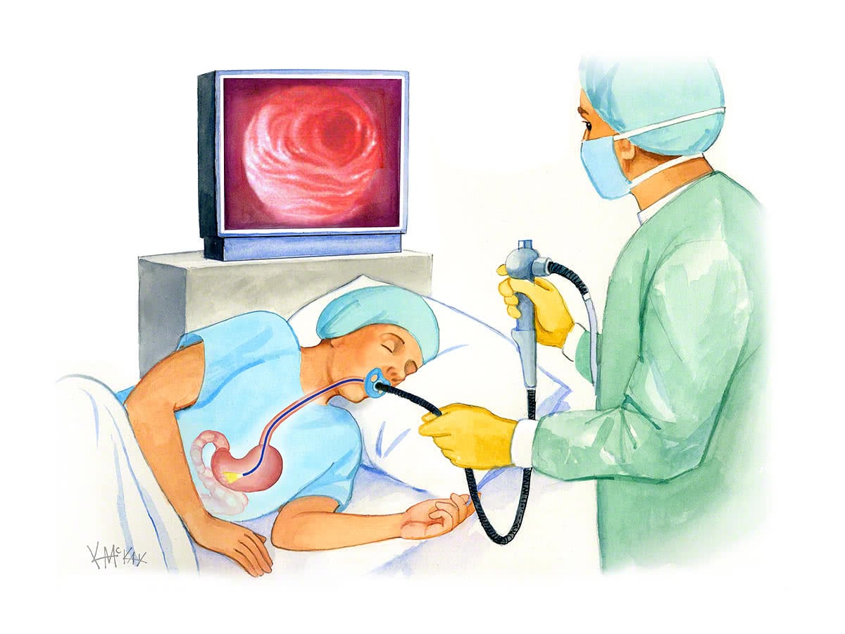 Gastroscopy Ahilyanagar