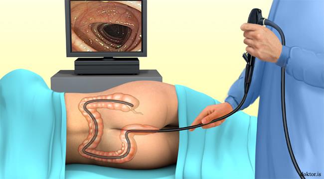 Colonoscopy Ahilyanagar